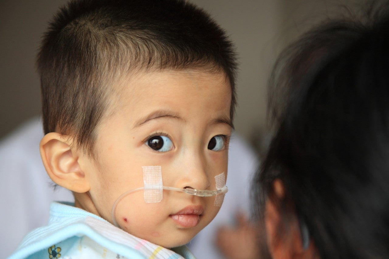 Meihui Zhang Healthy child after receiving a congenital heart disease corrective surgery.